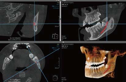 caso clinico bondream bondent (1)