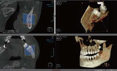 caso clinico bondream bondent (3)