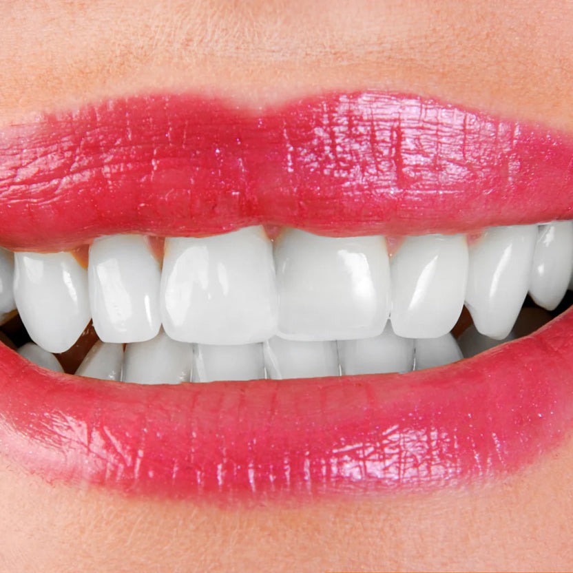 Tiras Blanqueadoras hismile dientes (1)